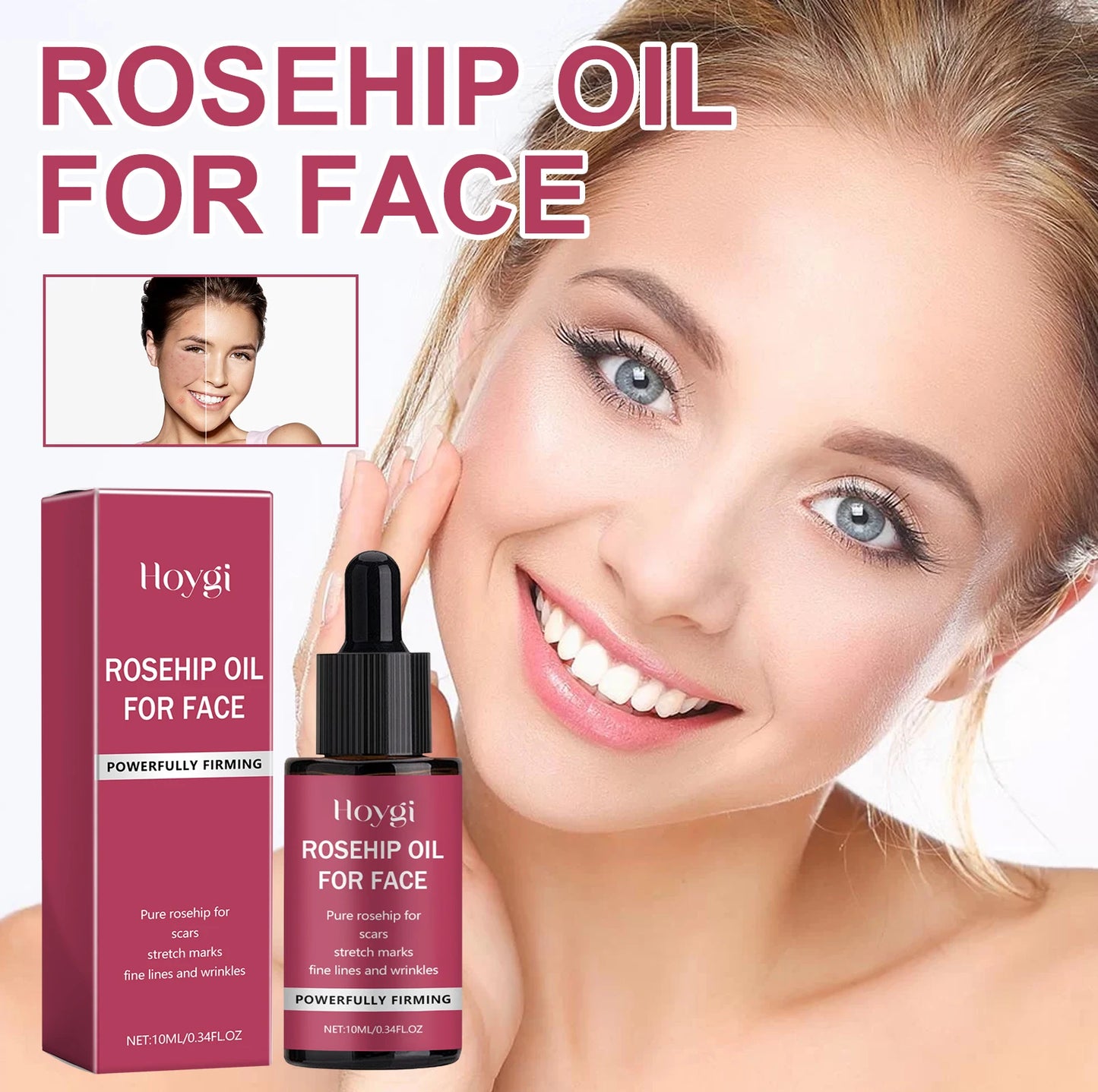 Pure Rosehip Oil Firming Delicate Pores Smooth Repair Facial Moisturizing Fade  Fine Lines Wrinkles Acne Blackheads Face Care